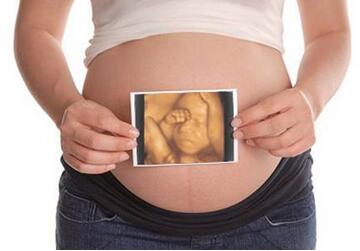 三个月胎儿彩超_怀孕三个月四维彩超检查什么？