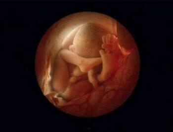 什么是寄生胎？寄生胎能活吗？
