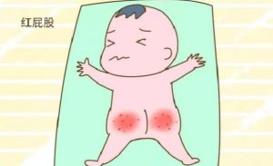 护臀膏能治疗宝宝的红屁屁吗？