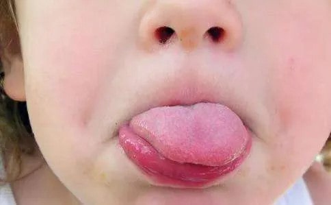 宝宝舌苔发白增厚是什么原因