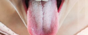 孕妇舌头发白什么原因