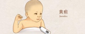新生儿黄疸是什么