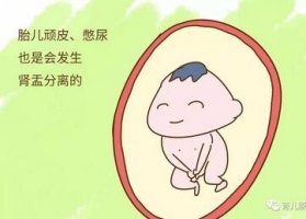 肾盂分离孕妇注意事项