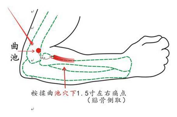 发烧搓哪个部位退烧快的5个穴位图 成人儿童都适用