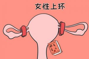 为什么不建议女人上环