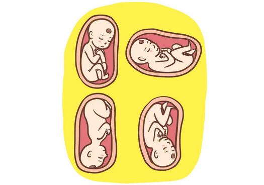 孕晚期胎位不正，还能顺产吗？怎么纠正？