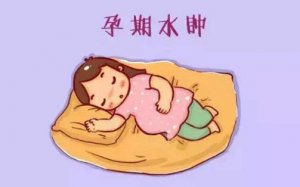 孕妇水肿的原因