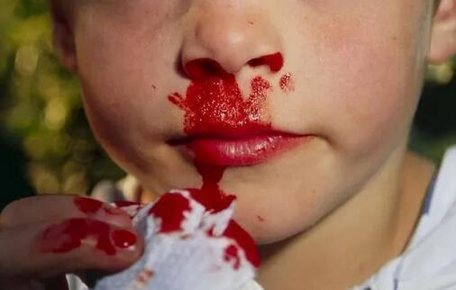小孩流鼻血了，第一步该怎么办？