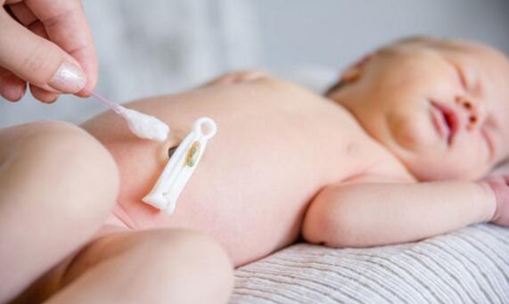 新生儿脐带该怎么护理？什么时候脱落？