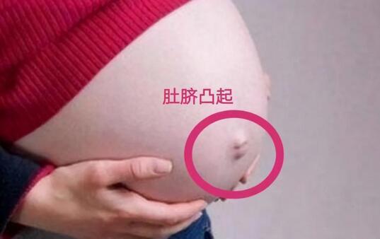 孕妇肚脐为啥有凹有凸，和生男生女有关？