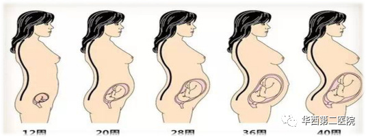 怀孕腰痛的原因有哪些