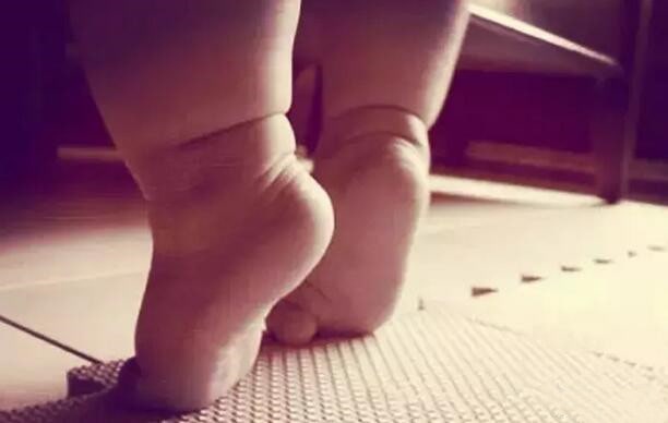 宝宝走路总喜欢踮起脚尖正常吗