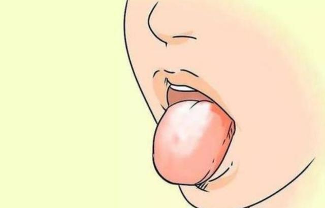 舌苔发白是什么原因呢