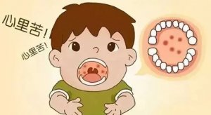 小儿疱疹性咽峡炎如何护理和预防