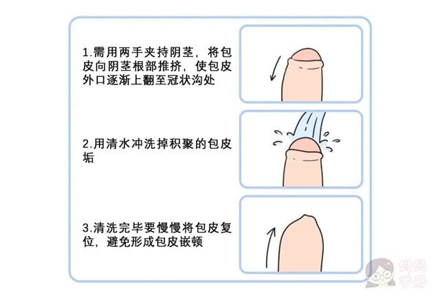 男孩要不要割包皮？几岁割？