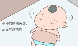婴儿出现枕秃是缺钙吗？