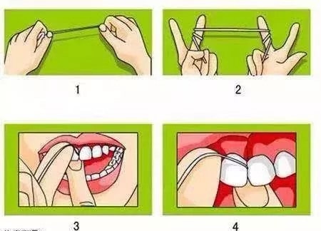 牙线怎么使用方法