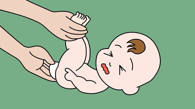 婴儿母乳性腹泻怎么办