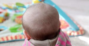 关于宝宝头发，5大问题答疑解惑