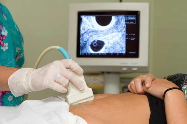 监测排卵对怀孕有什么帮助？