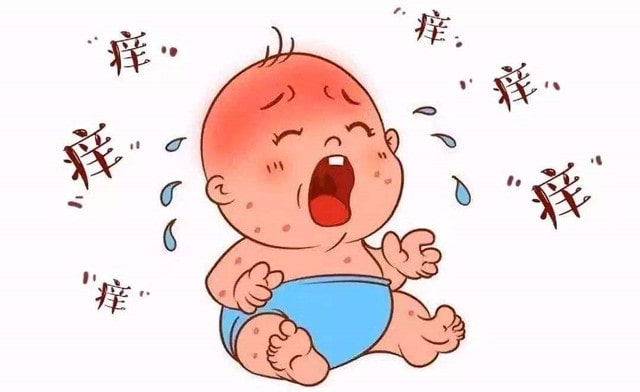 宝宝湿疹是什么原因引起的