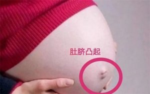 孕妇肚脐有凹有凸，和生男生女有关？
